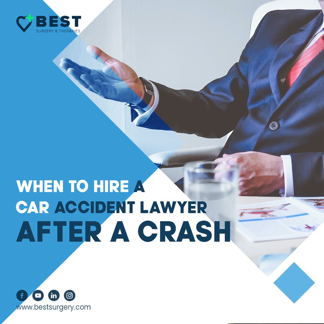 When to Hire a Car Accident Lawyer After a Crash