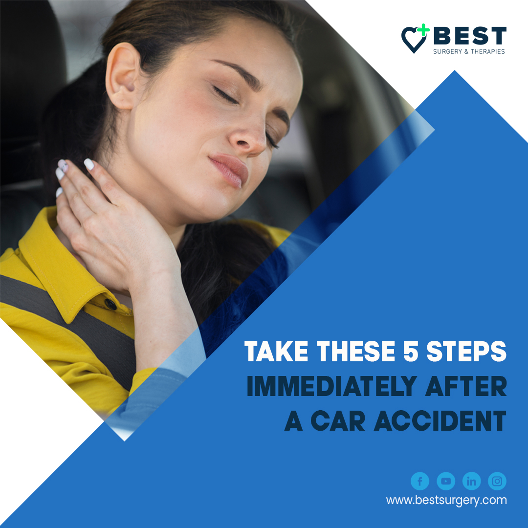 Take These 5 Steps Immediately After a Car Accident