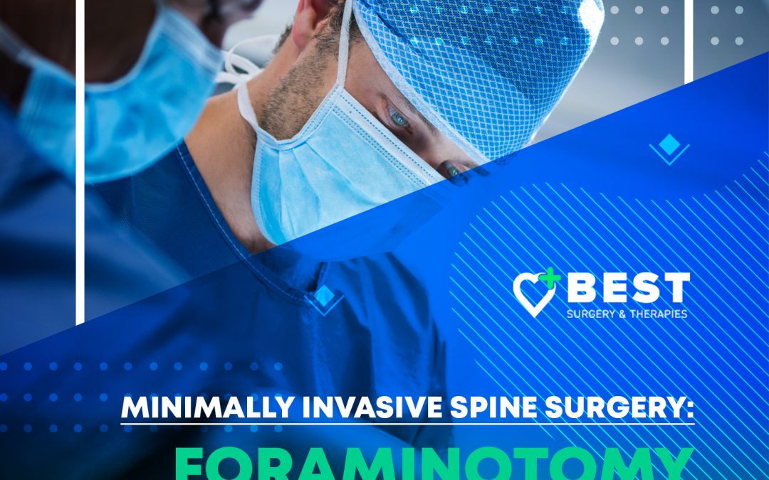 Minimally Invasive Spine Surgery: Foraminotomy