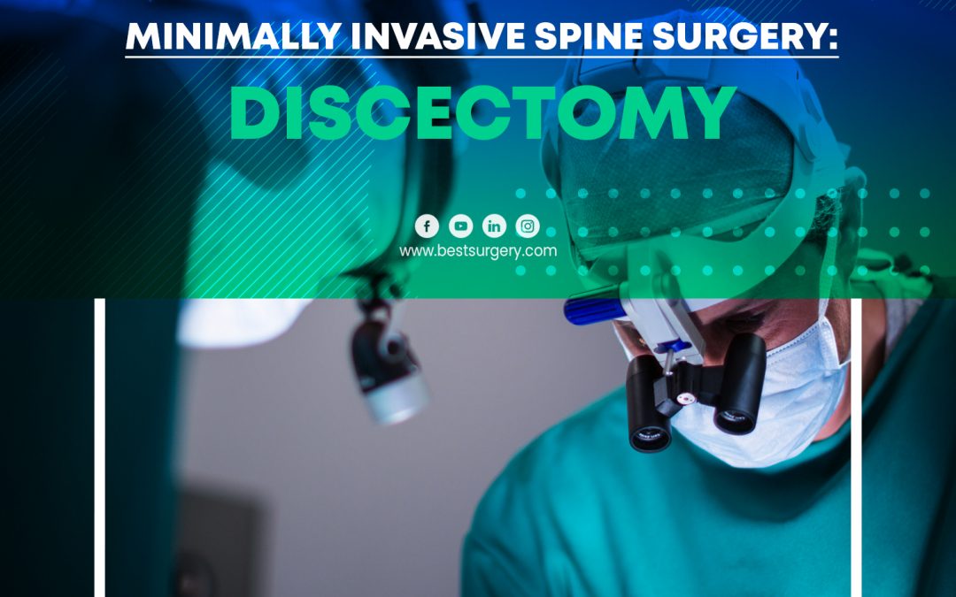 Cirugía de columna mínimamente invasiva: discectomía