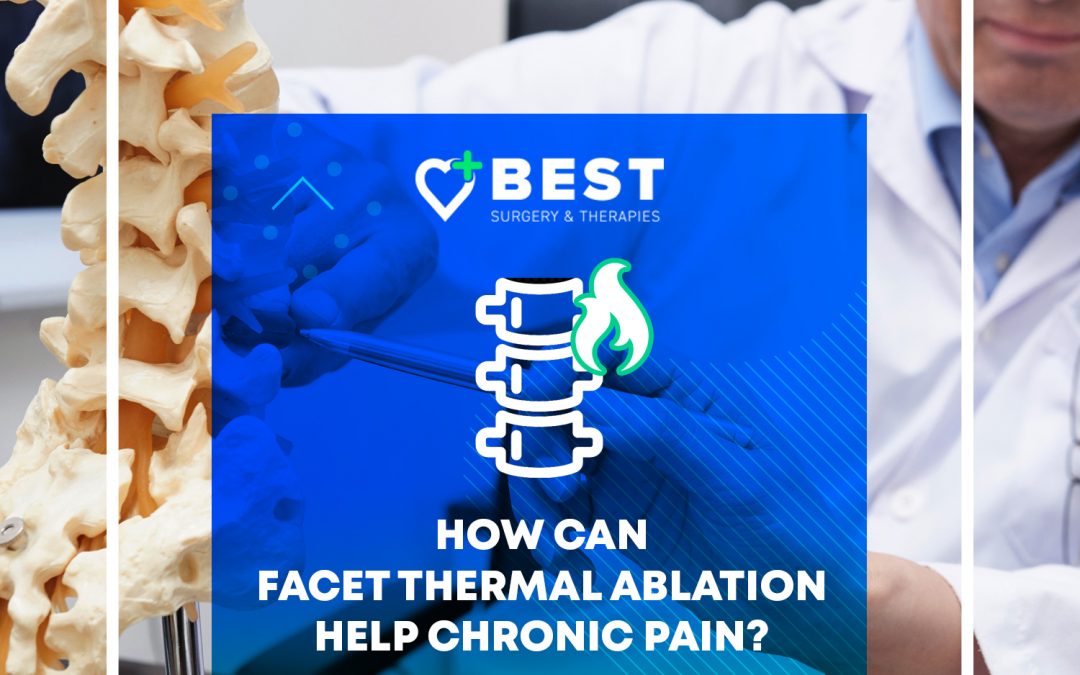 How Can Facet Thermal Ablation Help Chronic Pain?