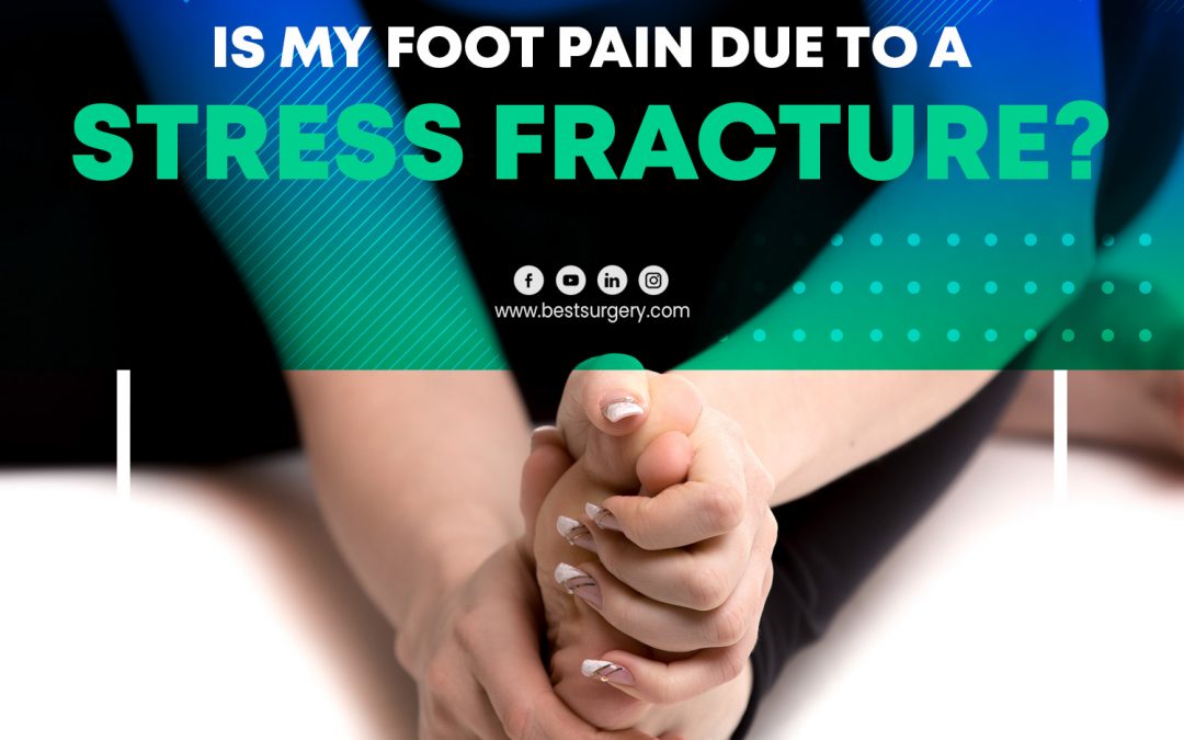 ¿El dolor de mi pie se debe a una fractura por estrés?
