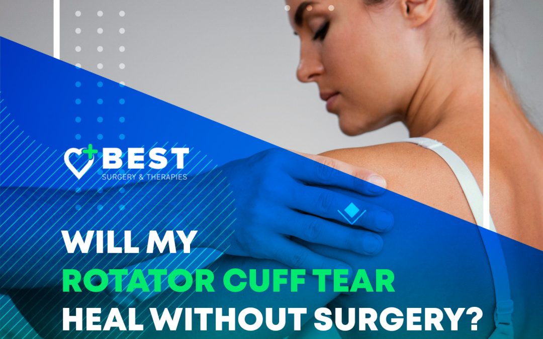 Will My Rotator Cuff Tear Heal Without Surgery?
